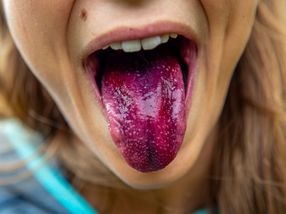 Eine bioelektronische Zunge "schmeckt" die Süße
