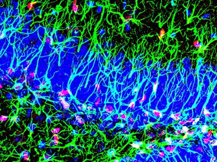 New mechanism discovered to activate stem cells in the adult brain