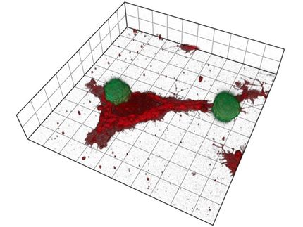 Mit Killerzellen gegen Hautkrebs