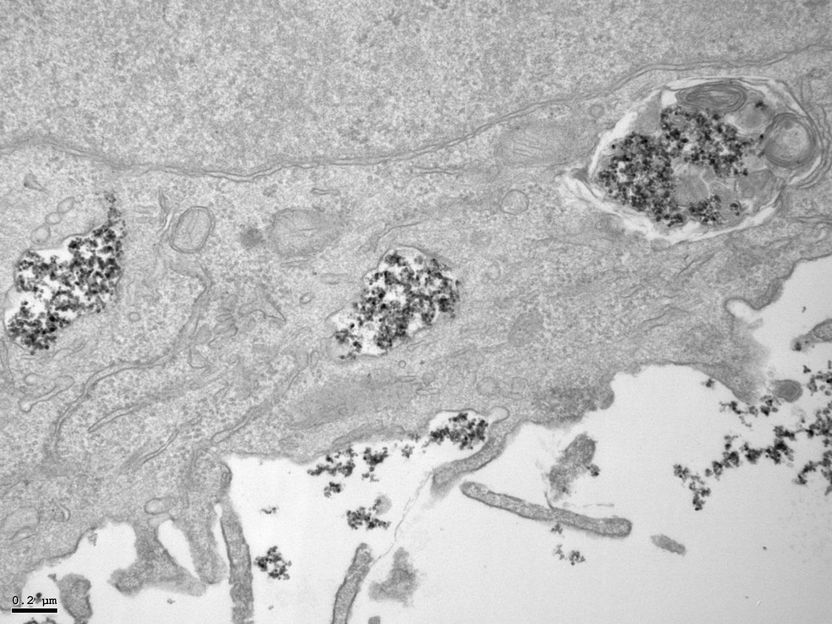 Magnetic metal nanoparticles for targeted drug delivery and tumor treatment - Nanoparticle coating as the main factor determining how nanoparticles move and degrade within the cell.