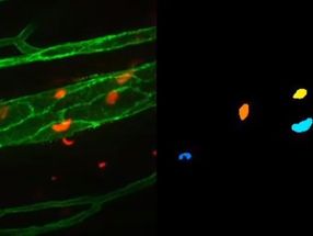 New computer vision system designed to analyse cells in microscopy videos