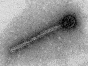 Última línea de defensa: cómo se protegen las poblaciones bacterianas contra las infecciones víricas
