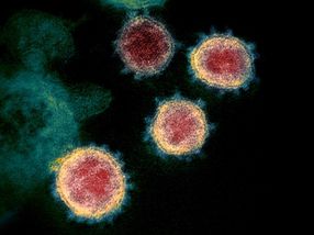 Wie das Medikament Plitidepsin die Vermehrung von SARS-CoV-2 in Zellen hemmt