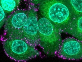 Künstliche Virus-Partikel zur Erforschung des Coronavirus