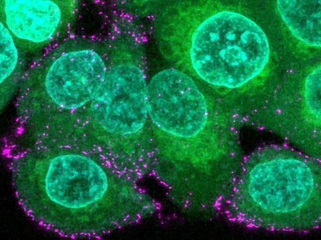 Building synthetic virus particles to study Sars-CoV-2 - Researchers create minimalistic Sars-CoV-2 virions and discover the spike protein switching mechanism