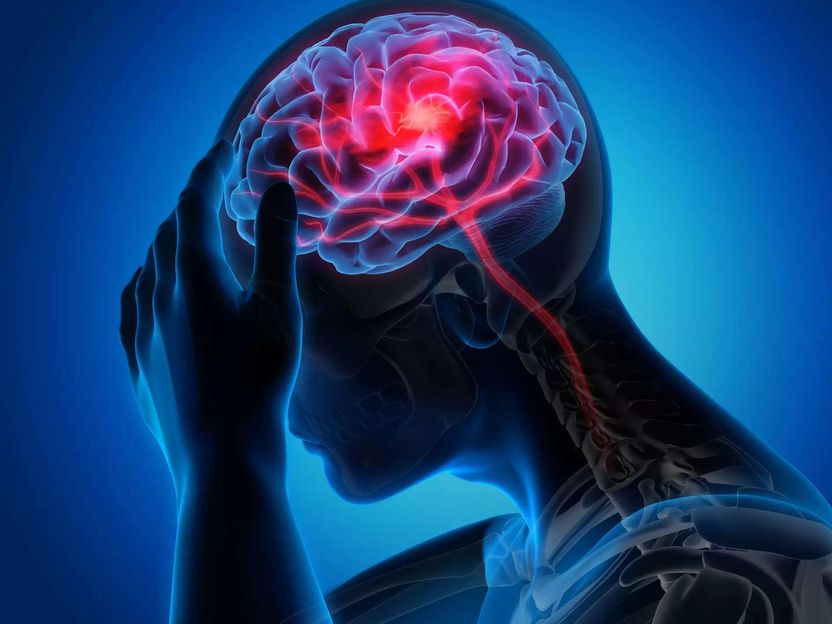 El ictus cerebral mata las neuronas mediante ondas eléctricas letales - Este accidente cerebrovascular no mata las células nerviosas por toxicidad química, como se creía hasta ahora, según revela un estudio internacional con investigadores del CSIC