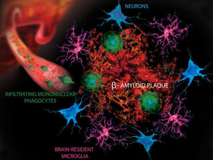 ¿Podría ser la filtración de los vasos sanguíneos del cerebro la culpable de la enfermedad de Alzheimer?