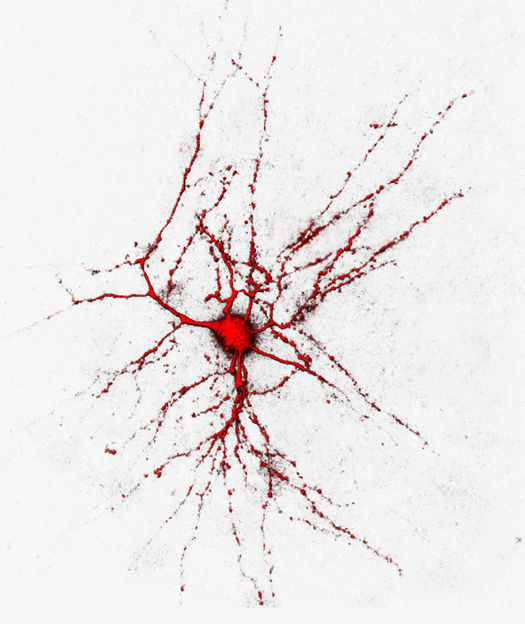 Max-Planck-Institut für Neurobiologie, Martinsried