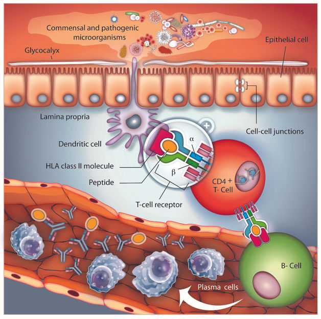 Single-cell analysis of Crohn's disease reveals a detailed picture of  inflammation in the gut