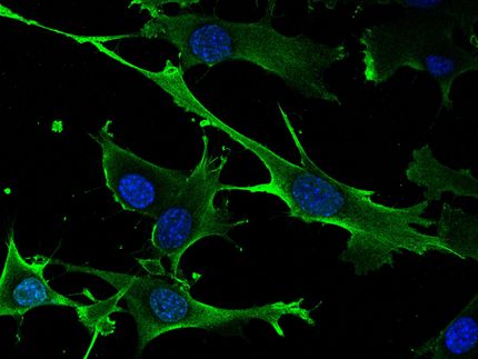 Entdeckung eines neuen krebsauslösenden Gens und seiner therapeutischen Schwächen