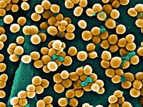 Mechanismus der Zellteilung in einem der tödlichsten Superbakterien aufgedeckt