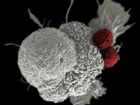 Biotech startup aims to advance groundbreaking T-cell therapies