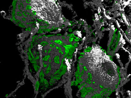 MPI für experimentelle Medizin