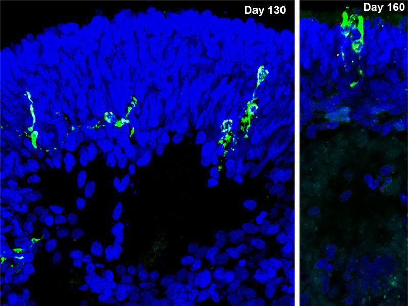 MPI für molekulare Biomedizin / Yotam Menuchin-Lasowski