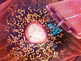 Organ transplantation Cell level: Using a nanosyringe, researchers take up mitochondria (blue) from a living cell in order to transfer the organelles into another.