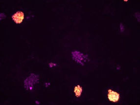 Immunofluorescent microscopy images show the different morphology of reprogrammed pluripotent stem cells (orange) and cells that were not reprogrammed (purple).