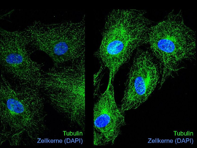 Institute of Molecular Cell Biology/ UKJ / Katrin Spengler