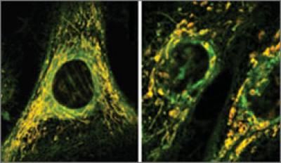 Dodging antibiotic side effects - New insights into how antibiotics damage human cells suggest novel strategies for making long-term antibiotic use safer