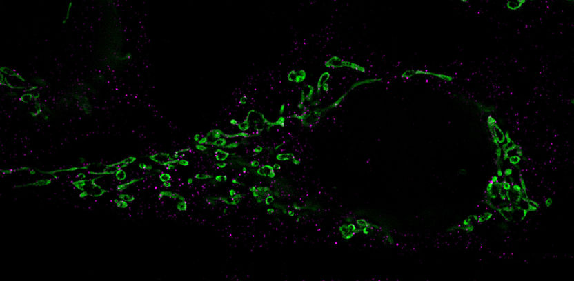 Wie Herpesviren aufwachen - Schlafende Herpesviren induzieren ihre Reaktivierung über einen bisher unbekannten, mikroRNA-vermittelten zellulären Mechanismus