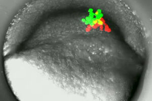 Die Wanderlust der Zelle erforscht - Ob Fischembryonen oder Tumore beim Menschen – das gleiche Gen kontrolliert, wie Zellen im Gewebe wandern