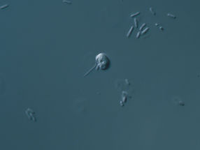 Chromatin entstand in alten Mikroben vor ein bis zwei Milliarden Jahren