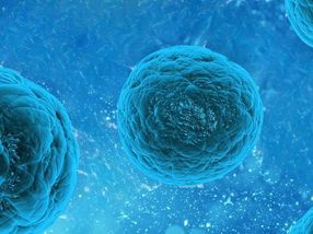 New solution for stem cell manufacturing
