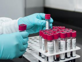 Durchbruch: Erstmals Bluttest für Parkinson in Aussicht