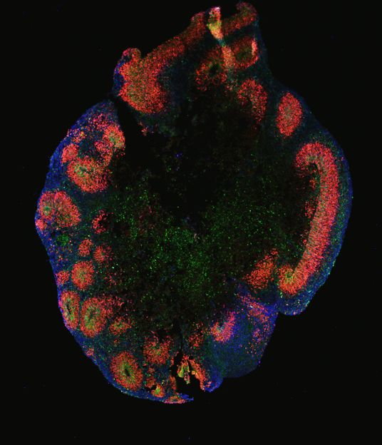 Cell-culture breakthrough: Advanced “mini brains” in the dish - Organoids that mimic human brain cortex in development and disease