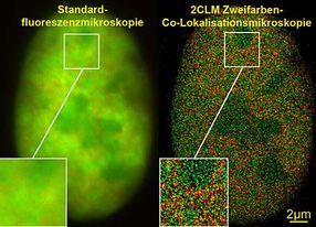 Mit gewoehnlichen Fluoreszenzfarbstoffen lebende Zellverbuende nanoskopisch untersuchen