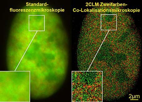 Mit "gewöhnlichen" Fluoreszenzfarbstoffen lebende Zellverbünde nanoskopisch untersuchen - Heidelberger Wissenschaftler realisiert Lokalisationsmikroskopie mit grün leuchtendem Protein