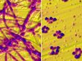 Nuevas pistas sobre el desarrollo de la enfermedad de Parkinson: El cobre provoca la agregación de proteínas