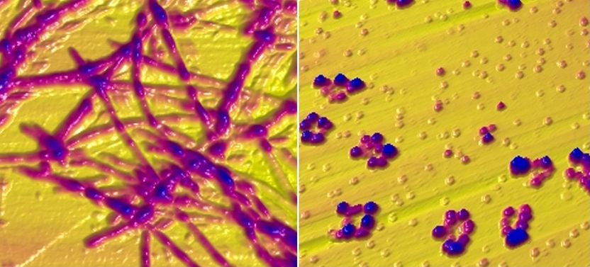 Targeting Alpha-Synuclein: Breakthroughs in the Quest to Halt Parkinson's  Progression