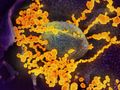 T-Zell-Immunantwort kann in immunsupprimierten Patienten die Vermehrung von SARS-CoV-2-Viren kontrollieren