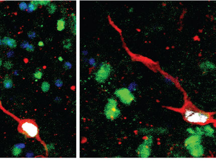 Deux exemples de neurones granulaires dentés immatures nouvellement nés dans des échantillons chirurgicaux d'hippocampe humain adulte en culture, marqués par des signaux de marqueurs superposés de neurones immatures (rouge), de neurones granulaires dentés (vert), de noyaux cellulaires (bleu) et de cellules nouveau-nées marquées par des analogues de nucléosides synthétiques (blanc).