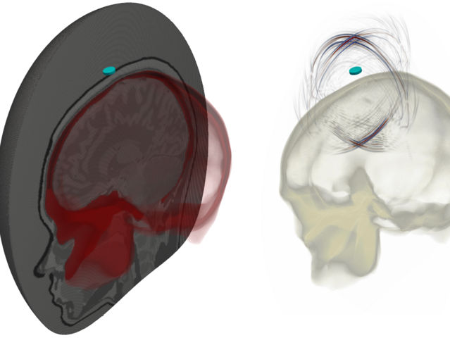 Marty, P. et al. Medical Imaging 2022: Physics of Medical Imaging; 120313H (2022) / ETH Zurich / CSCS