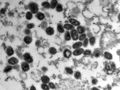 Les virus de la variole - vus ici au microscope - comptent parmi les agents pathogènes les plus mortels de l'histoire de l'humanité. L'épidémie actuelle de variole du singe est moins dangereuse, mais tout de même inquiétante.