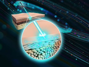 Los investigadores producen nanodiamantes capaces de administrar remedios medicinales y cosméticos a través de la piel