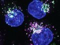 Neu identifiziertes Protein ermöglicht Krebszellen, auf alternative Nahrungsquellen auszuweichen