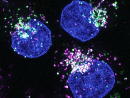 La descomposición de las proteínas: cómo las células cancerosas hambrientas cambian de fuente de alimentación