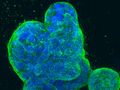 Garder les cellules cancéreuses agressives en échec