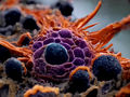 Las células cancerosas adoptan un estado hasta ahora desconocido para facilitar la metástasis