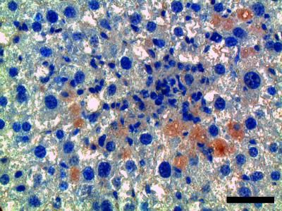 Immunity, Mchedlidze et al.