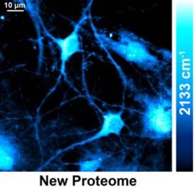 Watching the production of new proteins in live cells