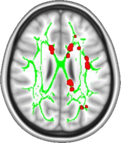 Courtesy of Apkarian lab, Northwestern University Feinberg School of Medicine.