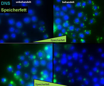 Genetischen Ursachen von Übergewicht auf der Spur