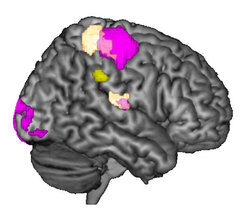 © MPI f. Kognitions- und Neurowissenschaften/Silani et al., The Journal of Neuroscience 2013