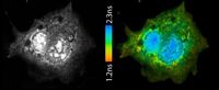 Dem Leben in der Zelle auf der Spur - Kostengünstige und anwendungsfreundliche Lösung für Wide-field Fluorescence Lifetime Imaging Microscopy (FLIM)