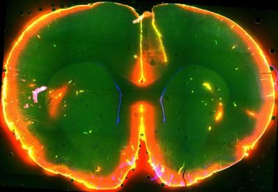 Courtesy of Nedergaard Lab, University of Rochester Medical Center