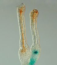 Gruene Stammzellen im Kleinen Blasenmuetzenmoos