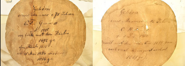 © Böttcher-Gajewski / MPI f. biophysikalische Chemie